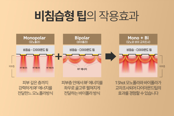 홍대피부과, 포텐자 진짜 효과 있을까? 의사가 답변해 드립니다.