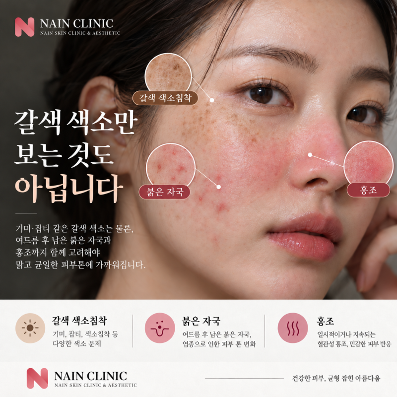 Klinik Kulit Hongdae: Apakah Perawatan Pigmen Benar-Benar Cukup dengan Pico Toning Saja? 사진 4